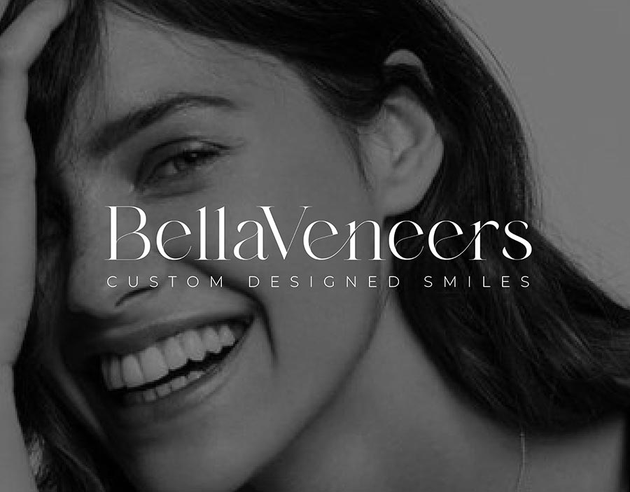 BellaVeneers by Dental Lab Direct - Snap-on Veneers for a Radiant Look Without Grinding Teeth