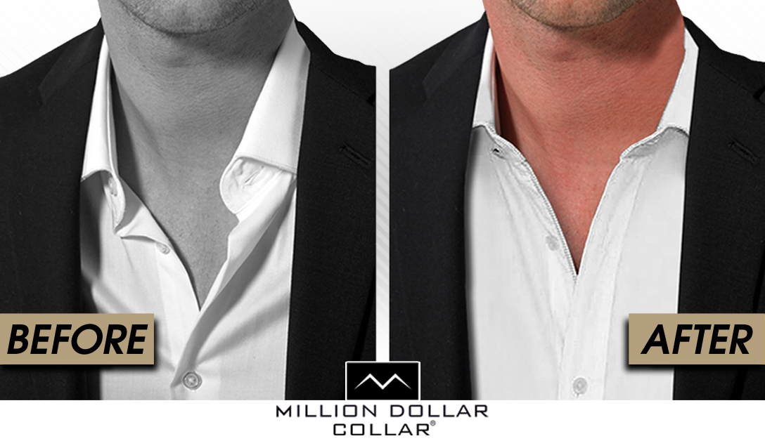 Million Dollar Collar before and after